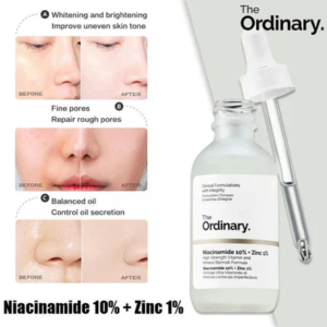 the ordinary niacinamide serum 10% + zinc 1% supersize serum 30ml | best quality serum 30ml